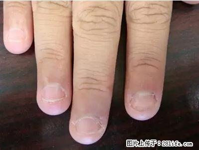 剪指甲、挖耳屎，这些日常小动作竟隐藏大危害！ - 怒江生活资讯 - 怒江28生活网 nujiang.28life.net